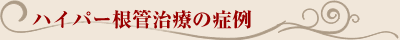 抜歯しない治療 ハイパー根管治療の症例